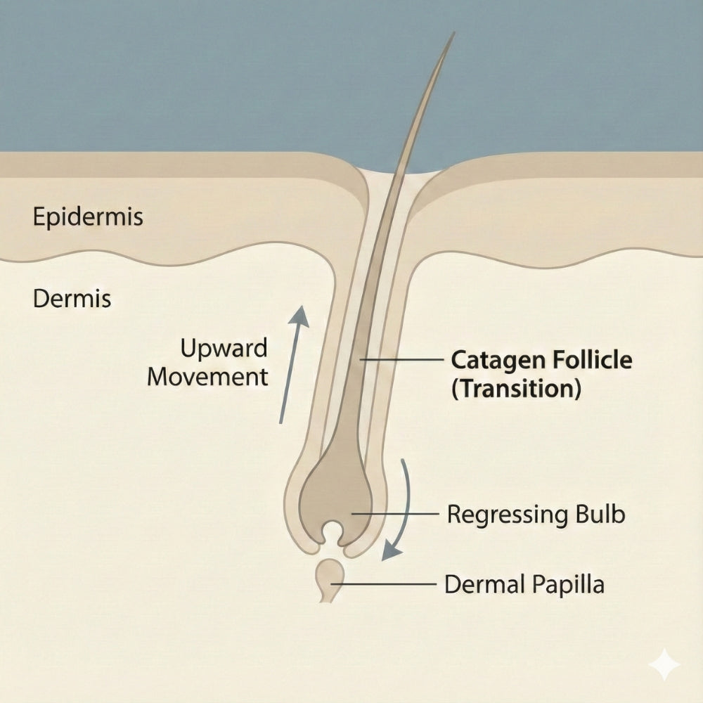 Illustratie van een haarfollikel in de catagene fase (overgangsfase), met regressie van de haarbulb, opwaartse beweging van de follikel en zichtbare dermale papil.
