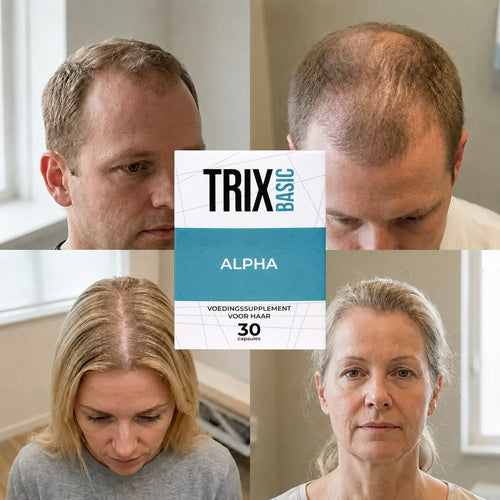 TRIX Basic Alpha für Haarausfallmuster, die mit androgenetischer Alopezie bei Männern und Frauen einhergehen.